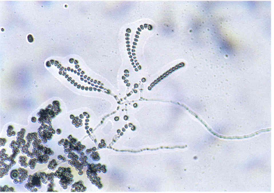 Нити мицелия споры. Грибы кандида микроскопия. Мицелий гриба микроскопия. Кандида плесневые грибы. Кандида альбиканс микроскопия.