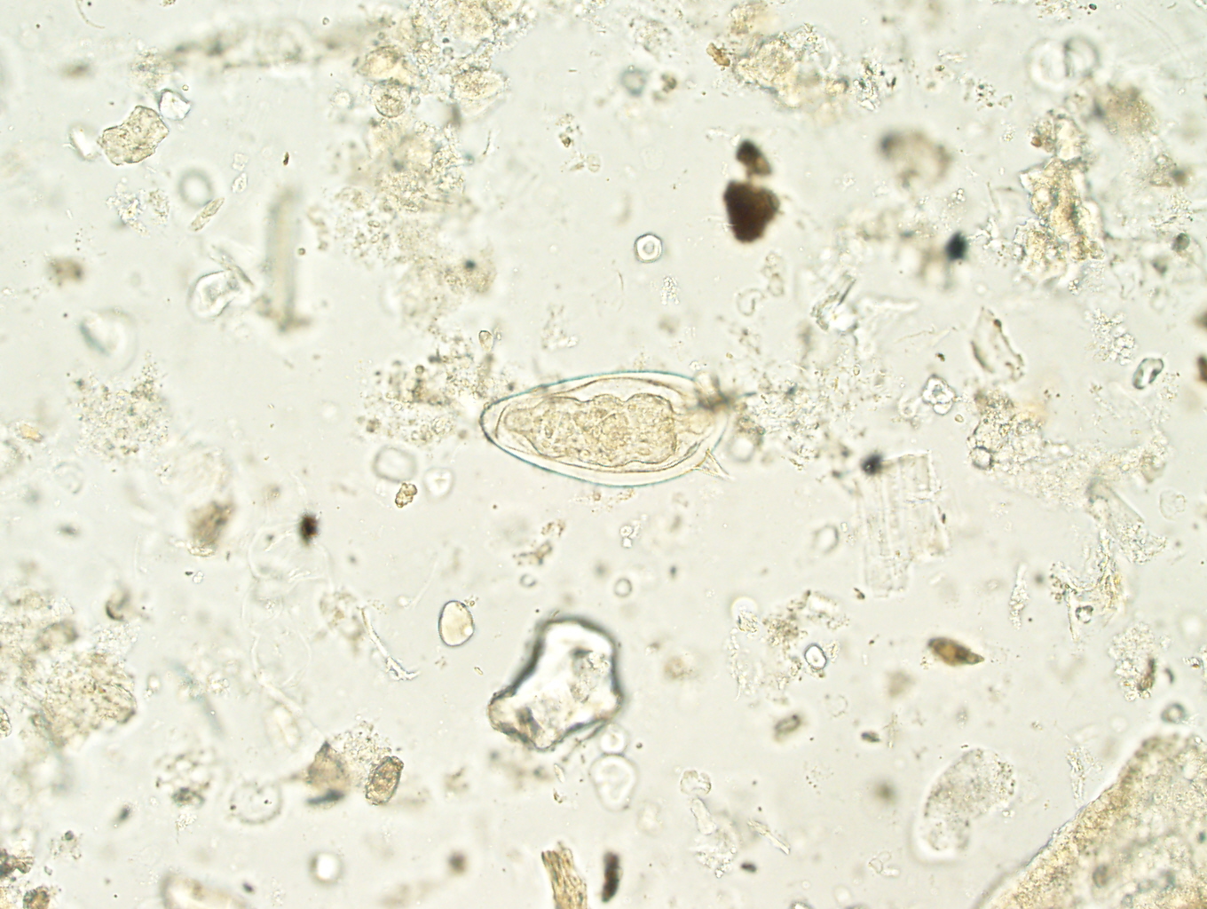 Споры в кале у взрослого. Цисты лямблии микроскопия. Цисты лямблий под микроскопом. Цисты лямблий микроскопия.