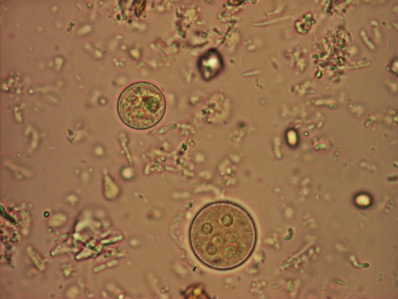 Споры в кале у взрослого. Цисты лямблии микроскопия. Цисты лямблий микроскопия кала. Циста лямблии под микроскопом. Цисты кишечной амебы (Entamoeba coli).