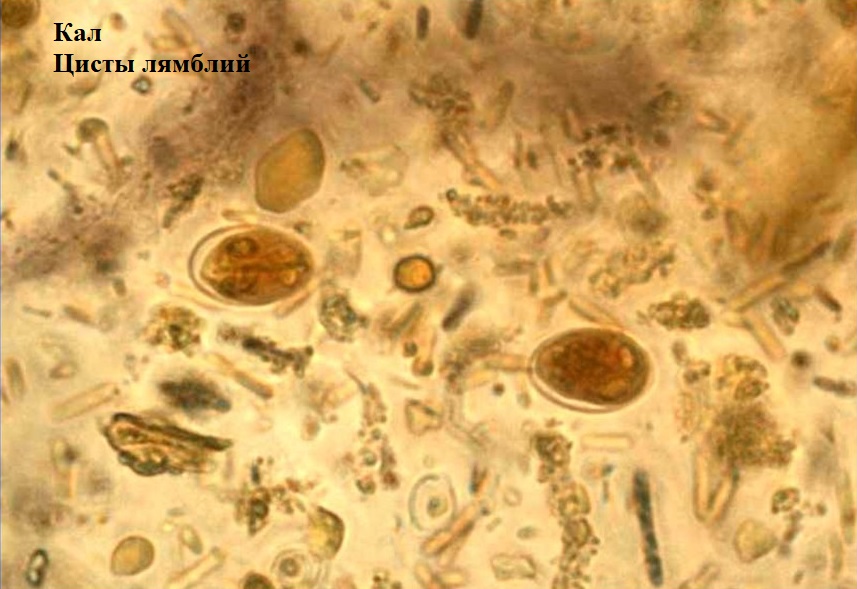Споры в кале у взрослого. Цисты лямблии микроскопия. Микроскопия кала яйца гельминтов. Циста лямблии под микроскопом.